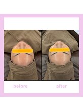 キワミビューティ(KIWAMI BEAUTY)/塗る金の糸/ビフォーアフター