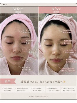 リアウェイク(Reawayke)の写真/丁寧なケアでシミくすみケアを目指し、1回の施術で効果を実感！透明感ある輝くお肌へ☆