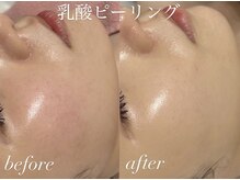 シーラックス(Sealax)の雰囲気（繰り返す乾燥・赤みも肌状態に合わせて丁寧にケア）