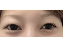 エシア(ECIA)/ラッシュリフト