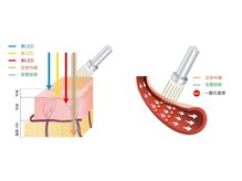 ブリエテル(Brietel)/