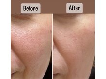 プレシャスサロン(precious salon)/ヴェリテパック～ホームケア～