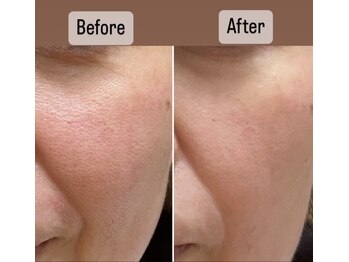 プレシャスサロン(precious salon)/ヴェリテパック~ホームケア~