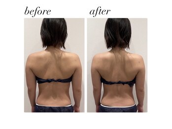 メディカルサロン MARUYAMA/[インディバ]　ボディ