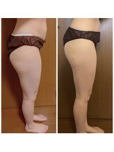 ヨサパーク ラリマー(YOSA PARK Larimar)/ビフォーアフター30代