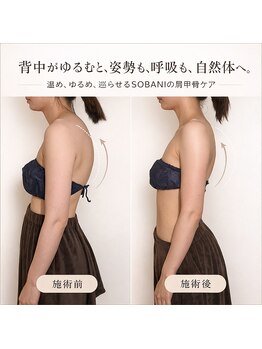 ソバニ(SOBANI)/肩甲骨はがし　巻き肩・猫背改善