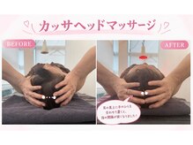 則武の整骨院の雰囲気（眼精疲労・頭皮のコリにはカッサがおすすめ◎）