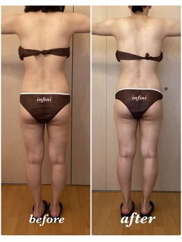 アンフィニ(infini)/短期集中コース7回目(1.5ヶ月)