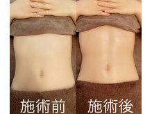 クオコア(KUOKOA)の雰囲気（痩せたい部分を徹底施術！【お腹引き締め/くびれ/女性専用】）