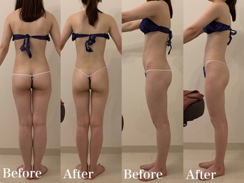 ラヴィエ ベル(La vie est belle)/セルライトゼロ2 全身