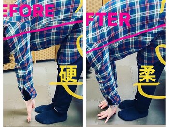 腰痛特化整体院 山本/前屈時の腰痛before　afteｒ