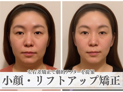 モアフェイス 池袋店(More Face)の写真