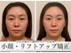 モアフェイス 池袋店(More Face)の写真