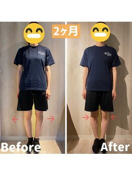 サニー(SUNNY)/O脚改善★