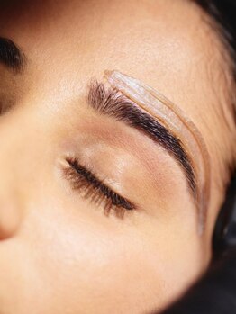 メディカル サンテロッソ(MEDICAL SANTEROSSO)の写真/[フェイスワックス脱毛＋最新美肌マシン]古い角質・産毛までケアして速攻ツルツルに♪