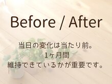ほねつぎ極癒/【 Before / After 】