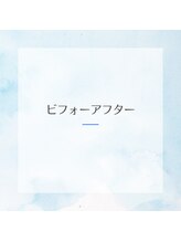 レストアハウス(RESTORE HOUSE)/骨盤を整えるだけでも変化◎