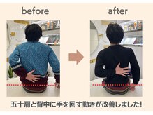 フィクシブ 上野(FIXIBE)/背中に手が回るようになりました