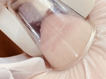 リリ(Ririi)の写真/北陸で希少な360℃脂肪冷却機器導入♪“超結果重視”の最新痩身で驚きの効果実感！激痩せ☆