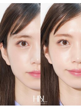 ミーククル(MEKUKURU)/眉毛-ハリウッドブロウリフト