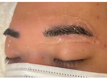 アンベリール みなとみらい店(Embellir)/10　クーリング＆保湿