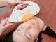 グランビューティ(Glanz Beauty)の写真/【速攻効果】肌に優しい美肌顔脱毛♪敏感肌にも◎眉間・鼻・もみあげ広範囲に照射！男性の髭脱毛にも◎