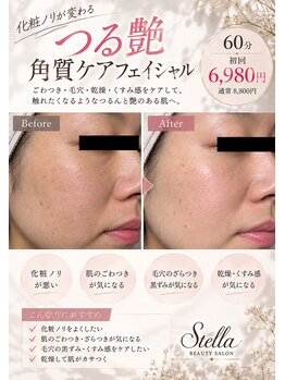 ステラ(Stella)の写真/【毛穴・ごわつきに】角質ケア×たっぷり保湿で、つるんと艶肌へ♪