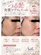 ステラ(Stella)の写真/【毛穴・ごわつきに】角質ケア×たっぷり保湿で、つるんと艶肌へ♪