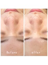 デジール(DESIR)/続ければ続けるほどクリアな毛穴