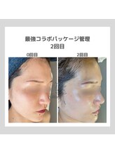 ポムハヌル(pom.haneul)/韓国肌管理室