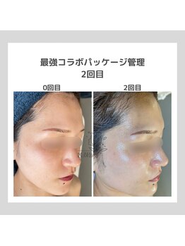 ポムハヌル(pom.haneul)/韓国肌管理室