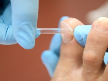 巻き爪専門ラボ 豊田店/巻き爪施術