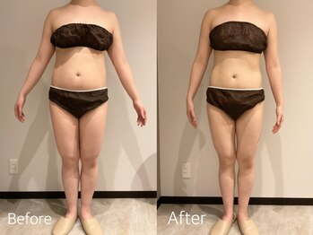 エステティック ミュー(Esthetic MiEUX)/全身痩せコース