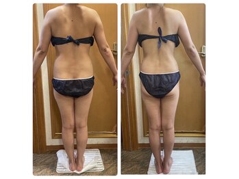 トータルビューティー エステサロン