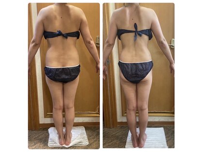 トータルビューティー エステサロンの写真