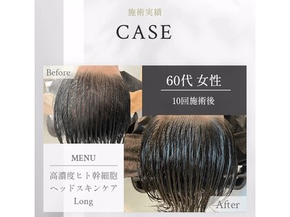 クレーレ(Klare)の写真