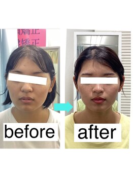 シンメトリー 千葉店/圧倒的な技術力で理想の顔へ