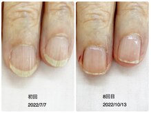 キアラネイル(Chiala nail)/自爪育成