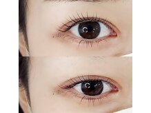 ビアン(B:an)/逆まつ毛解消！