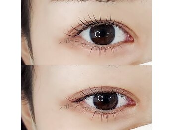 ビアン(B:an)/逆まつ毛解消！