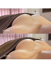 リノア(Linoa)/ふわもちバストアップ