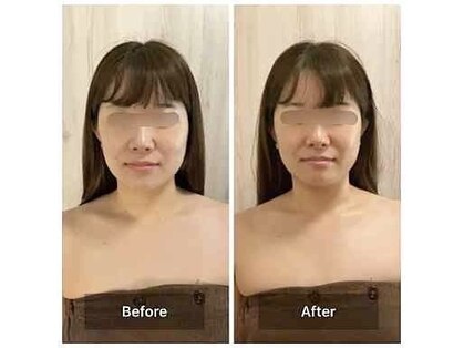 パピヨン(papillon)の写真