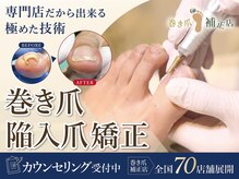 銀座巻き爪補正店の雰囲気（全国７０店舗の実績！巻き爪補正店）