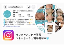 エミレル(Emirel)の雰囲気（ビフォーアフターお写真たくさん載ってます◎）