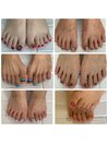 お客様フットネイル 4本アート