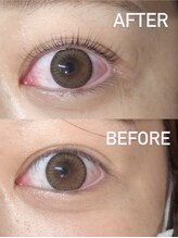 フリーダム(freedom)/井原　ゆい