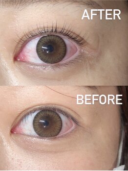 フリーダム(freedom)/井原 ゆい