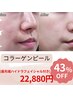 水光肌人気NO.2【コラーゲンピール】+ハイドラフェイシャル+マスク付22880円