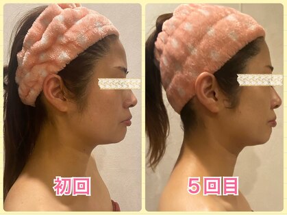 美肌痩身サロン ラエルヴェ(La Elever)の写真