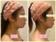 美肌痩身サロン ラエルヴェ(La Elever)の写真